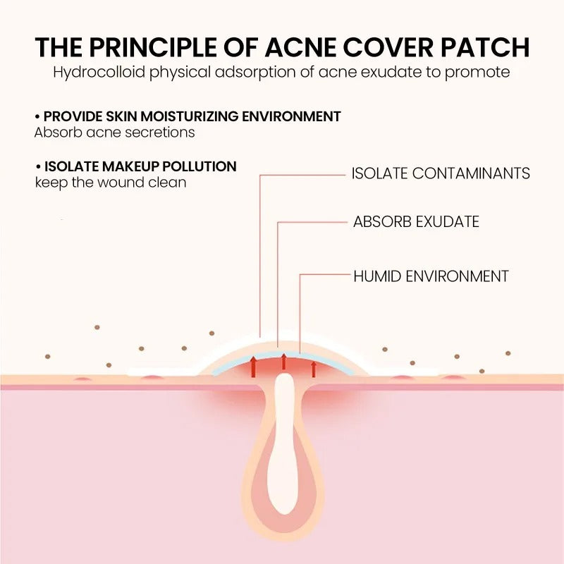 Pimple Stars Hydrocolloid Acne Patches (400 Patches)