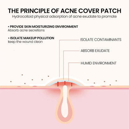 Pimple Stars Hydrocolloid Acne Patches (400 Patches)